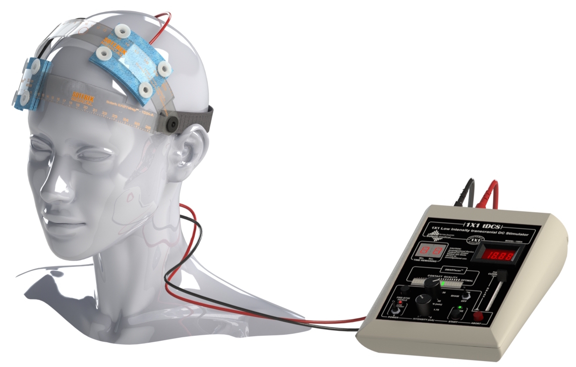 TdCS